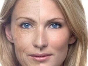 A bőr pigmentációja