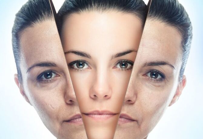 Az arcbőr eltávolításának folyamata az életkorral összefüggő változásokból